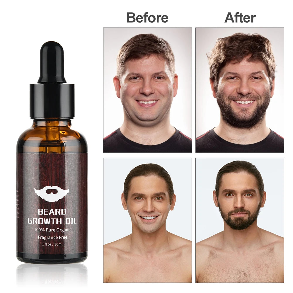 Kit Completo de Crecimiento y Cuidado de Barba para Hombre – 5 Piezas