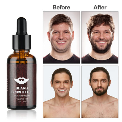 Kit Completo de Crecimiento y Cuidado de Barba para Hombre – 5 Piezas